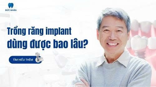 Trồng răng Implant dùng được bao lâu?